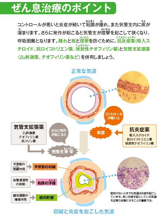 喘息治療のポイント